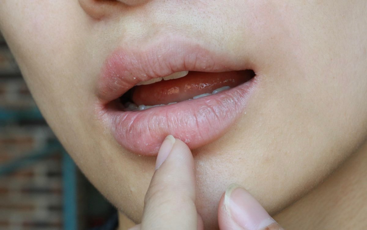 cómo cuidar los labios