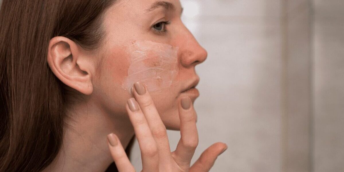 Mujer con manchas en la cara