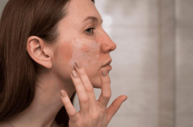 Mujer con manchas en la cara